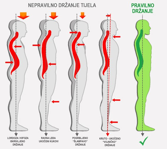 Nepravilno držanje tijela